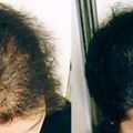 「アップヘアー発毛システム」の体験者です。20年の実績と研究…